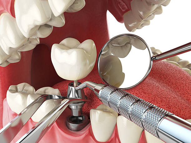 Best Broken or Cracked Tooth Emergency Dentist in Sheldon, IA